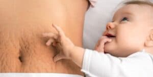 شكل البطن بعد الولادة